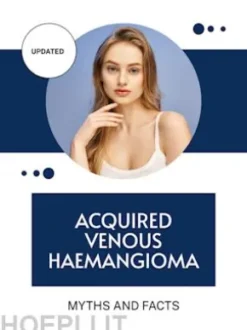 Acquired Venous Haemangioma
