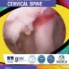 Contemporary Endoscopic Spine Surgery Volume 1: Cervical Spine