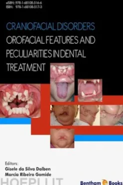 Craniofacial Disorders – Orofacial Features and Peculiarities in Dental Treatment
