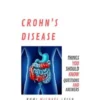 Crohn's disease