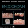 Endocrown