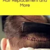 Hair Transplant Surgery