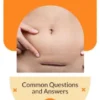 Hysterectomy