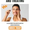 Identifying and Treating Acquired Palmoplantar Keratoderma