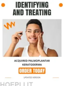 Identifying and Treating Acquired Palmoplantar Keratoderma