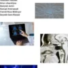 Integrative Approaches in Neurology and Hematology: Bridging Neurodegenerative Diseases, Cancer, and Deep Learning Innovations