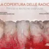 La copertura delle radici