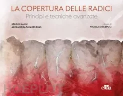 La copertura delle radici