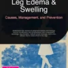 Leg Edema & Swelling: Causes, Management, and Prevention