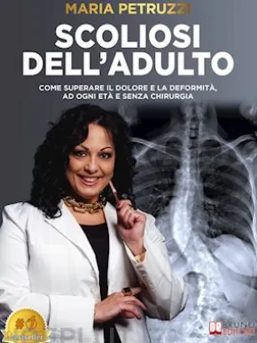 Scoliosi Dell'Adulto
