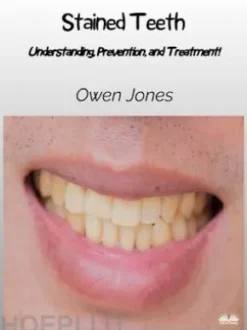 Stained Teeth