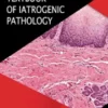 Textbook of Iatrogenic Pathology