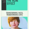 The Acne Effect