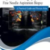 Thyroid Ultrasonography and Fine Needle Aspiration Biopsy: A Practical Guide and Picture Atlas
