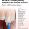 Tratamientos restauradores estéticos con composites y cerámicas en el sector anterior. Casos prácticos paso a paso