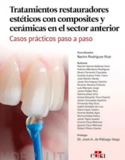 Tratamientos restauradores estéticos con composites y cerámicas en el sector anterior. Casos prácticos paso a paso