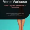 Vene Varicose: Guida Completa alla Gestione e Prevenzione